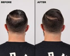 Matte Hair Cream With DHT Blocker -Personal Care Products ken before after